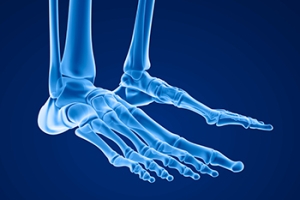 What Is Morton’s Toe?
