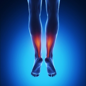 Painful Achilles Tendon Injury