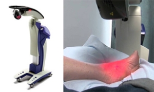 MLS Laser Therapy May Help Lessen Attacks of Raynaud’s Disease