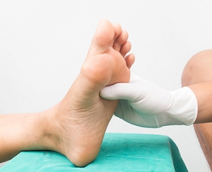 An Explanation of Peripheral Neuropathy