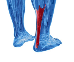 What Is Sever’s Disease?